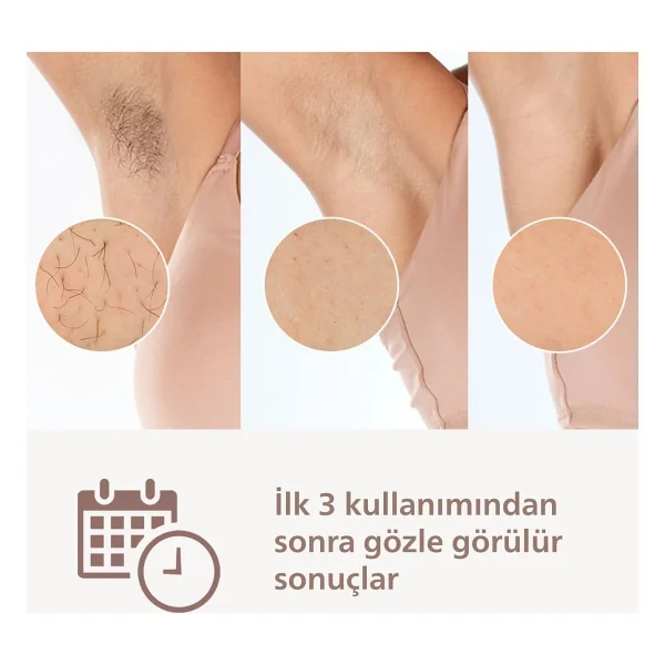 Philips Lumea Prestige Ipl Lazer Epilasyon Cihazı 450.000 Atım 3 Farklı Başlık Hem Kablolu Hem Kablosuz Kullanım, Uzun Ömürlü Kullanım, Smartskin Teknolojisi - Görsel 3