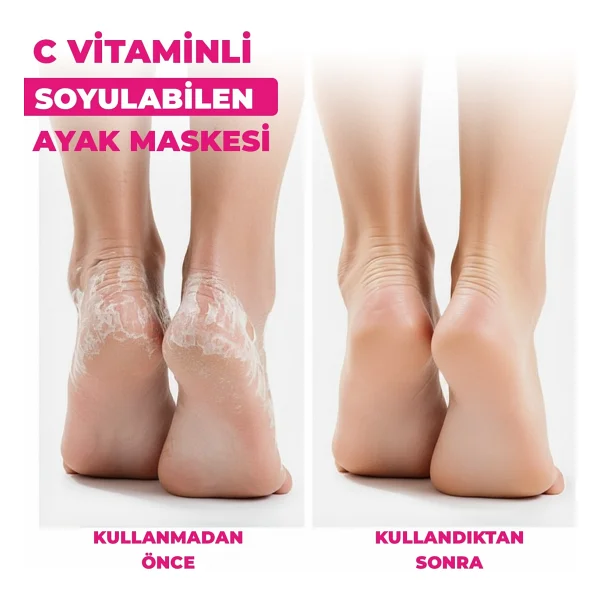 Dermokil C Vitaminli Peeling Etkili Soyulabilen 30 Ml Ayak Maskesi - Görsel 2