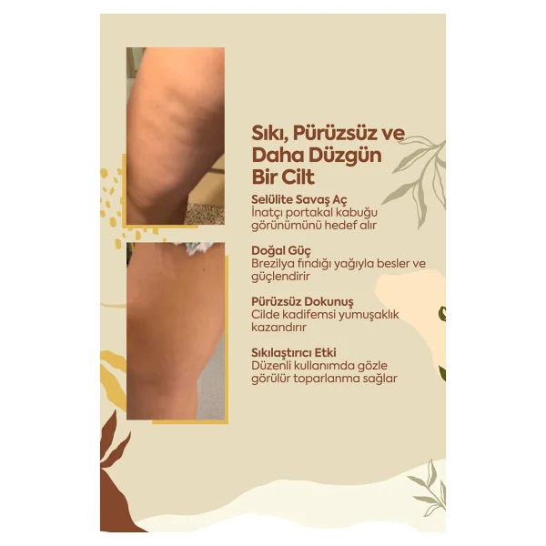 Clasy Care Anti Selülit Krem 100 Ml - Selülit Karşıtı, Unisex, Tüm Cilt Tiplerine Uygun Etkili Formül - Görsel 3