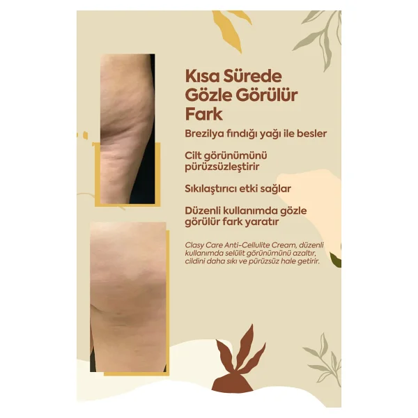 Clasy Care Anti Selülit Krem 100 Ml - Selülit Karşıtı, Unisex, Tüm Cilt Tiplerine Uygun Etkili Formül - Görsel 5