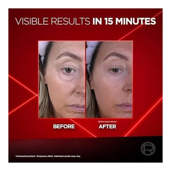 L'oreal Parıs Revitalift Lazer Eyebag Instant Eraser Göz Altı Torba Görünümüne Karşı Etkili Göz Kremi 15ml - Standart - Görsel 3