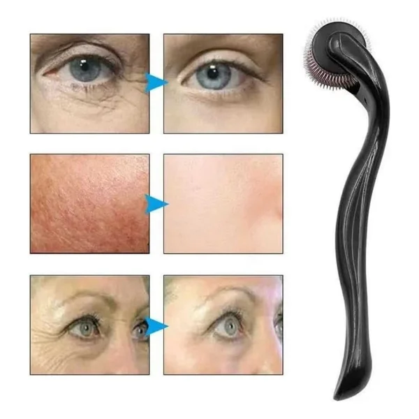 Dermaroller Titanyum 540 Iğneli 1 Mm Saç Kaş Sakal Serum Kullanıma Uygun - Lisinya - Görsel 2