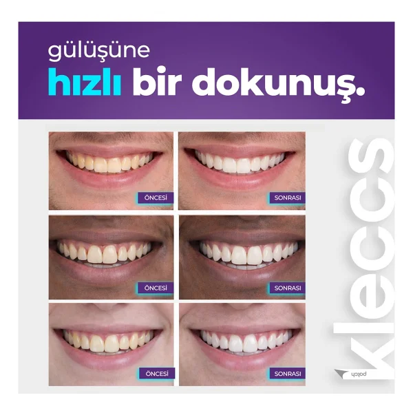 Kleccs Diş Beyazlatma Bandı, Hızlı Beyazlık, 14 Paket-28 Bant, Günlük Ve Bireysel Kullanıma Uygun - Görsel 6