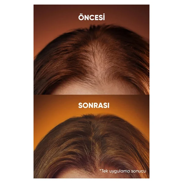 Luis Bien Hair Fiber Dolgunlaştırıcı Kahverengi Saç Spreyi 100 Ml - Görsel 4