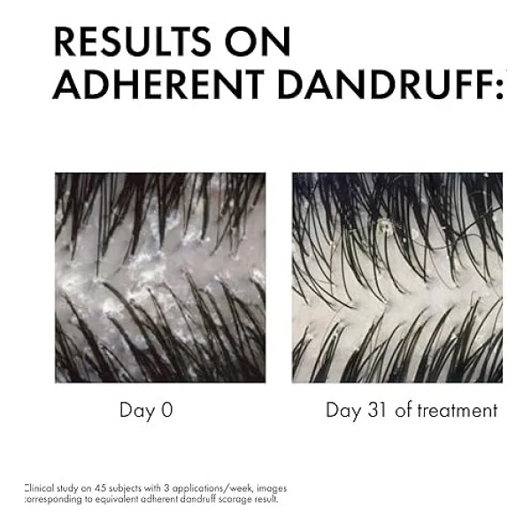 Vichy Dercos Anti-Dandruff 390 Ml Kepek Şampuanı - Görsel 2