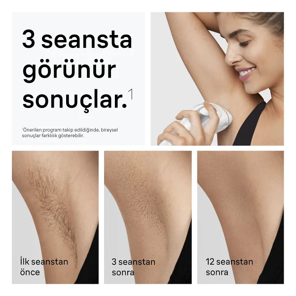 Braun Silk Expert Pro 3 Pl3122 Ipl Lazer Epilasyon Aleti - Görsel 5
