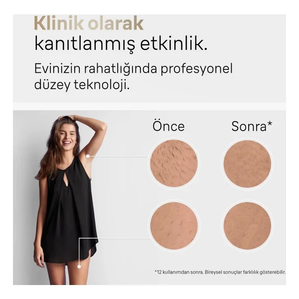 Braun Silk Expert Pro 5 Pl5152 Ipl Lazer Epilasyon Aleti - Görsel 5