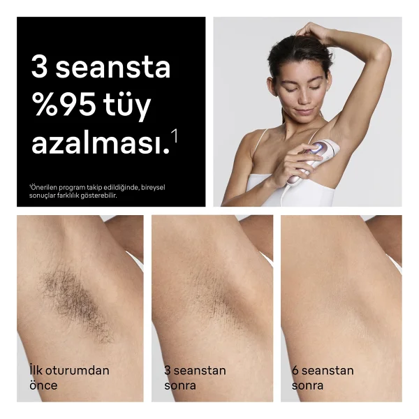 Braun Skin I-Expert Pl7431 Ipl Lazer Epilasyon Aleti - Görsel 5