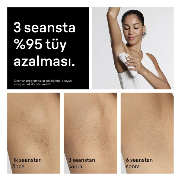 Braun Silk Expert Pro 5 Pl5351 Ipl Lazer Epilasyon Aleti - Görsel 6