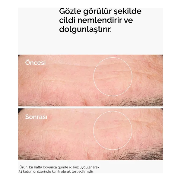 The Ordinary Pro-Vitamin B5 Nemlendirici 30 Ml Hyaluronik Asit Serum - Görsel 10