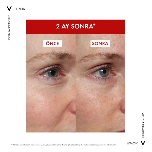 Vichy Liftactiv Collagen Specialist 16 Bonding 30 Ml Yüz Serumu - Görsel 5