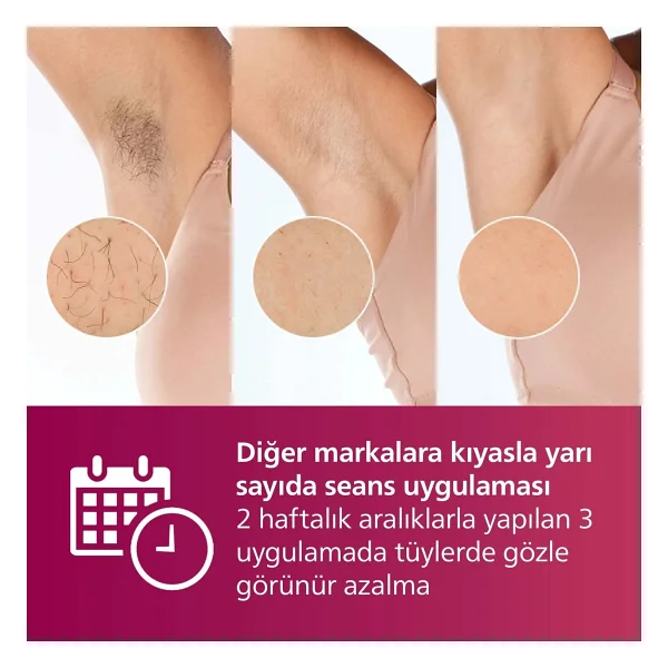 Philips Lumea Advanced Brı924/00 Ipl Lazer Epilasyon Aleti - Görsel 4
