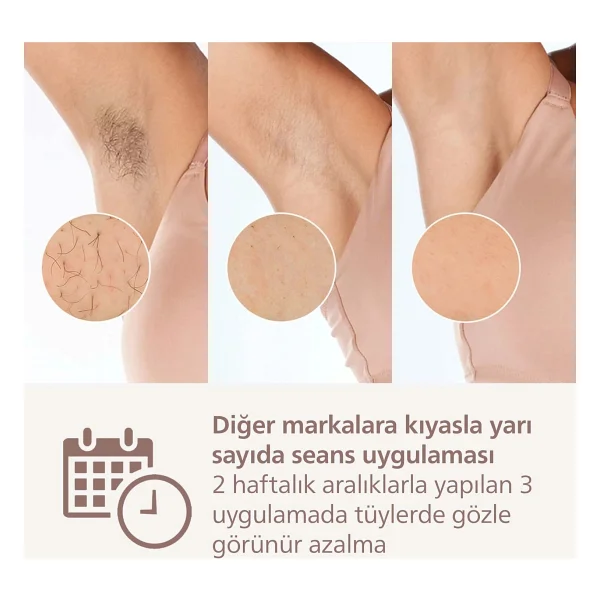 Philips Lumea Brı940/00 Ipl Lazer Epilasyon Aleti - Görsel 4