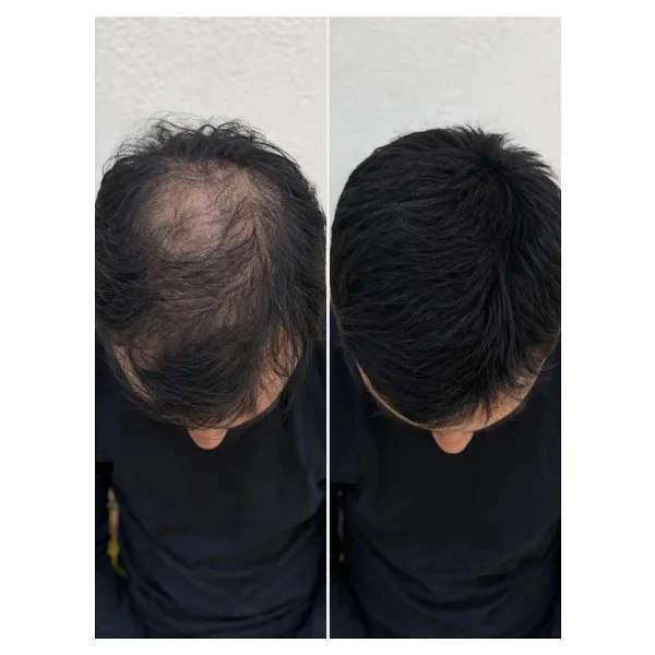Quad Siyah Saç & Sakal Toz Kapatıcı Dolgunlaştırıcı Pudra - Doğal Topik Etki 10gr - Görsel 9