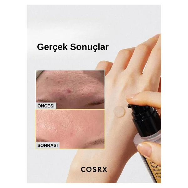 Cosrx Advanced Snail 96 Mucin Power Essence 100 Ml Salyangoz Ekstreli Esans - Görsel 9