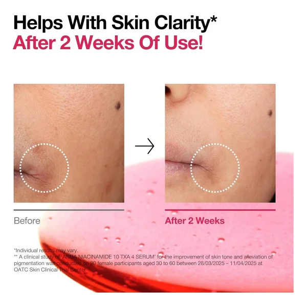 Anua Aydınlatıcı Ve Yaşlanma Karşıtı Txa 30 Ml Niasinamid Serum - Görsel 4