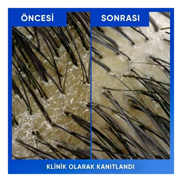 Head & Shoulders Arındırma Ve Parlaklık 800 Ml Kepek Şampuanı - Görsel 5
