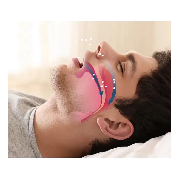 Rahat Uyku İçin Anti Snore Sleep Horlama Engelleyici Aparat - Görsel 2