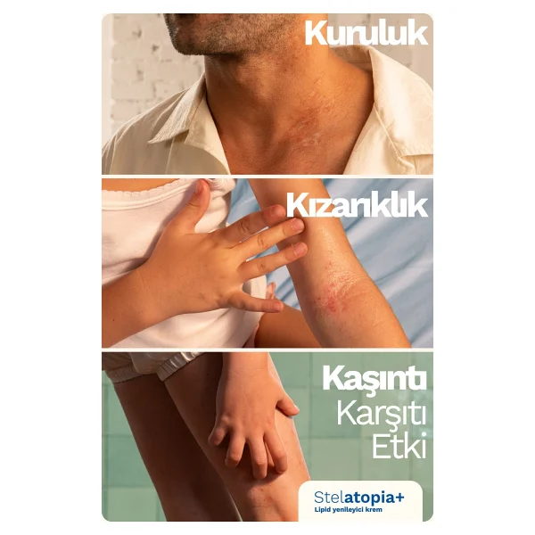 Mustela Stelatopia+ Lipit Yenileyici Krem 150 Ml - Görsel 10