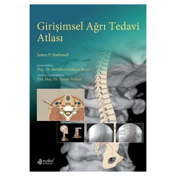 Girişimsel Ağrı Tedavi Atlası