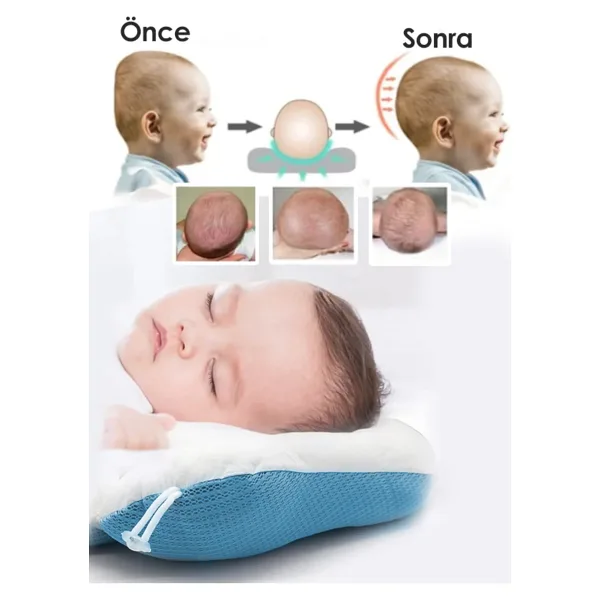 i lin baby Ayarlanabilir Bebek Kafa Yastığı, Bebek Yastığı, Yeni Doğan Yastığı, Bebek Uyku Yastığı.